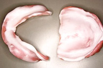 ティシュコンディショニング 