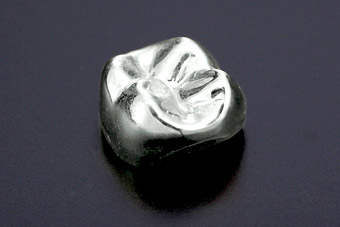 銀歯(保険適応)