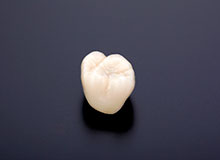 審美セラミック治療